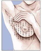 How to Perform a Breast Self-Exam